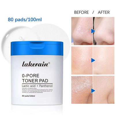 Zero Pore Toner Pads