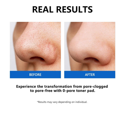 Zero Pore Toner Pads